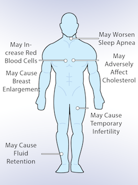 Testosterone Replacement Therapy Side Effects